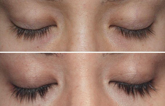 8 Best Lash Serums of 2024 Careprost