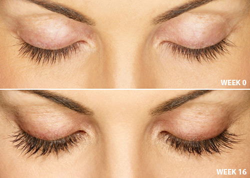 8 Best Lash Serums of 2024 Careprost