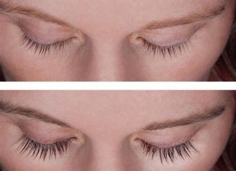 8 Best Lash Serums of 2024 Careprost