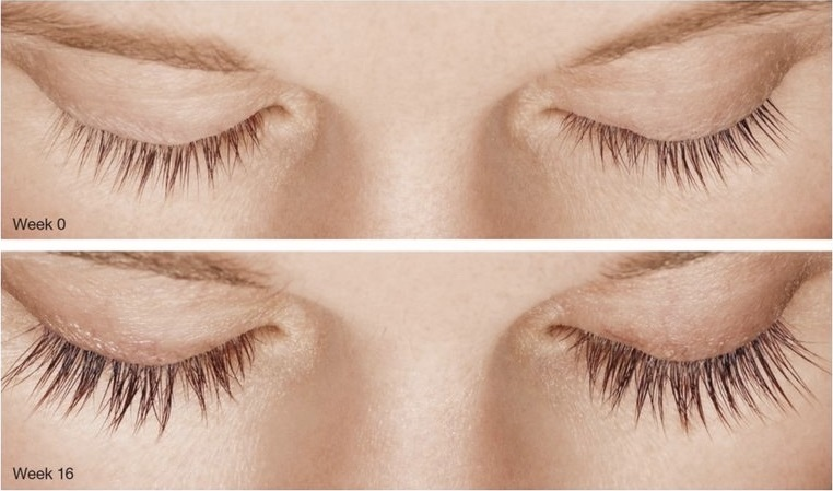8 Best Lash Serums of 2024 Careprost
