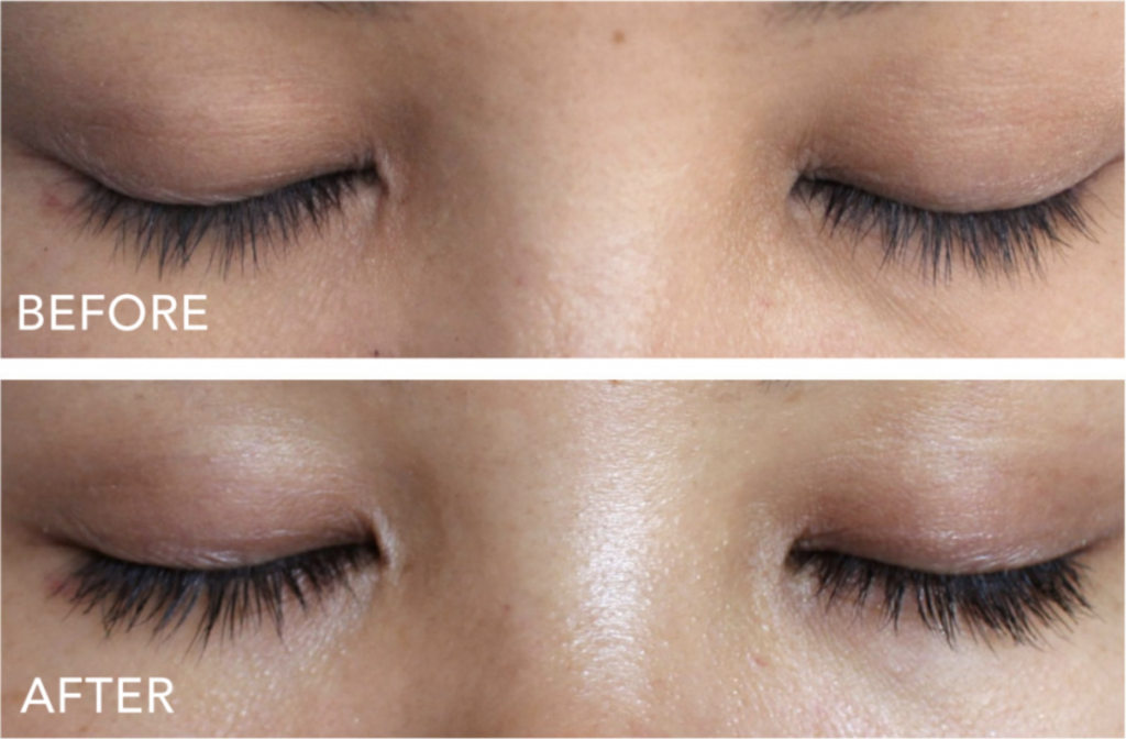 8 Best Lash Serums of 2024 Careprost